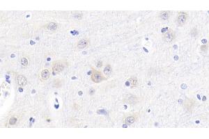 Detection of Cys-C in Porcine Cerebrum Tissue using Polyclonal Antibody to Cystatin C (Cys-C) (Cystathionine-gamma-Synthase Precursor (CYS) (AA 42-127) anticorps)