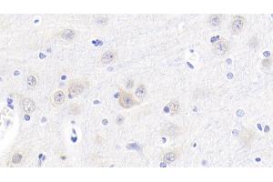 Detection of Cys-C in Porcine Cerebrum Tissue using Polyclonal Antibody to Cystatin C (Cys-C) (CST3 anticorps  (AA 42-127))