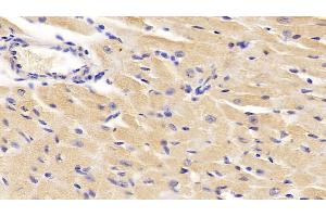 Detection of DBI in Mouse Cardiac Muscle Tissue using Polyclonal Antibody to Diazepam Binding Inhibitor (DBI)