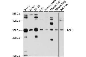 Western blot analysis of extracts of various cell lines, using L antibody (ABIN6131546, ABIN6143063, ABIN6143064 and ABIN6214255) at 1:1000 dilution. (LAIR1 anticorps)