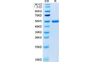 Cynomolgus 4-1BB Ligand on Tris-Bis PAGE under reduced condition.
