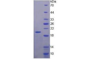 SDS-PAGE analysis of Human NAGase Protein. (MGEA5 Protéine)