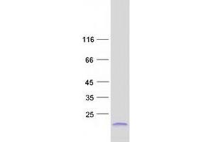 Validation with Western Blot