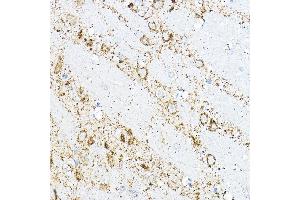 Immunohistochemistry of paraffin-embedded rat brain using BC Rabbit pAb (ABIN6131008, ABIN6137483, ABIN6137484 and ABIN6223295) at dilution of 1:100 (40x lens).