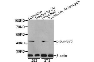 Western blot analysis of extracts of 293 and NIH/3T3 cells, using Phospho-Jun-S73 antibody (ABIN5969904) at 1/1000 dilution. (C-JUN anticorps  (pSer73, Ser73))