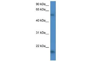 Human HepG2; WB Suggested Anti-GPT2 Antibody Titration: 0. (GPT2 anticorps  (C-Term))
