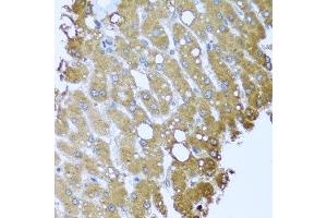 Immunohistochemistry of paraffin-embedded human liver injury using STRN antibody at dilution of 1:100 (x40 lens). (Striatin anticorps)