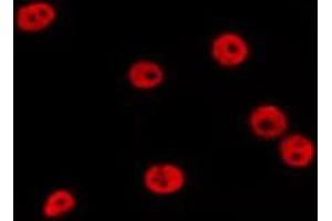 ABIN6278578 staining MCF7 by IF/ICC.