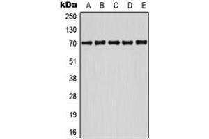 Western blot analysis of ATF2 (pS498) expression in HeLa UV-treated (A), Jurkat (B), NIH3T3 (C), SP2/0 UV-treated (D), MCF7 UV-treated (E) whole cell lysates.