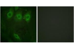 Immunofluorescence analysis of HeLa cells, using EGFR (Phospho-Tyr1016) Antibody. (EGFR anticorps  (pTyr1016))
