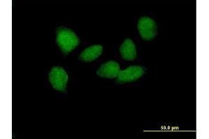 Immunofluorescence of purified MaxPab antibody to SOX6 on HeLa cell. (SOX6 anticorps  (AA 1-828))
