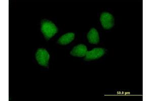 Immunofluorescence of purified MaxPab antibody to SOX6 on HeLa cell.