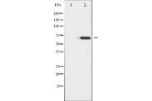 Western blot analysis of ZAP-70 expression in Jurkat whole cell lysates,The lane on the left is treated with the antigen-specific peptide. (ZAP70 anticorps  (Internal Region))