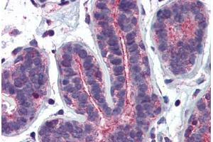 Human Breast: Formalin-Fixed, Paraffin-Embedded (FFPE)