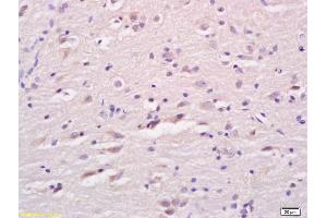 Formalin-fixed and paraffin embedded rat brain labeled with Anti LCAT Polyclonal Antibody, Unconjugated (ABIN676118) at 1:200 followed by conjugation to the secondary antibody and DAB staining (LCAT anticorps  (AA 151-250))