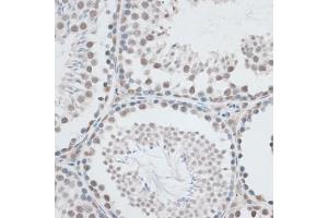 Immunohistochemistry of paraffin-embedded mouse testis using AQR antibody (ABIN6133411, ABIN6137057, ABIN6137058 and ABIN6221662) at dilution of 1:100 (40x lens). (AQR anticorps  (AA 400-700))