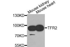 Western blot analysis of extracts of mouse kidney and mouse heart cells, using TFR2 antibody. (Transferrin Receptor 2 anticorps)