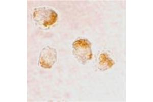 Immunocytochemistry staining of HL-60 cells using BAX polyclonal antibody  at 2 ug/mL . (BAX anticorps  (N-Term))