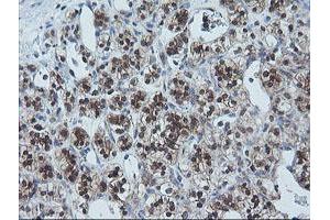 Image no. 2 for anti-Ubiquitin-Conjugating Enzyme E2G 2 (UBE2G2) antibody (ABIN1501630)