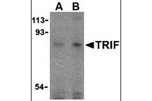 Western Blotting (WB) image for anti-Toll-Like Receptor Adaptor Molecule 1 (TICAM1) (C-Term) antibody (ABIN1030771)