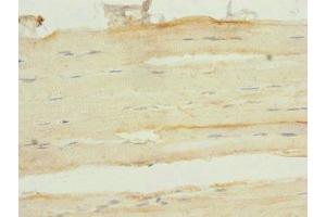 Immunohistochemistry of paraffin-embedded human skeletal muscle tissue using ABIN7153138 at dilution of 1:100