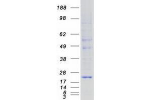 Validation with Western Blot
