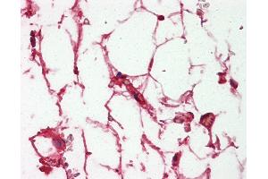 Anti-Complement C3/C3c antibody IHC of human adrenal, adipocytes. (Complement C3c anticorps)