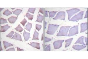 Immunohistochemistry analysis of paraffin-embedded human skeletal muscle tissue, using XIAP (Ab-87) Antibody. (Intestinal Alkaline Phosphatase anticorps  (AA 53-102))