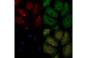 ABIN6257590 and ABIN6274935 staining  cells by IF/ICC.
