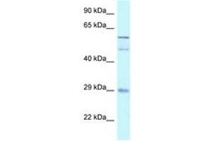 Image no. 1 for anti-GDNF Family Receptor alpha 4 (GFRA4) (AA 182-231) antibody (ABIN6747540) (GFRA4 anticorps  (AA 182-231))