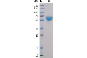 Human 4-1BB Protein, mFc-His Tag on SDS-PAGE under reducing condition.