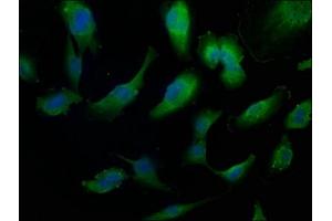 Immunofluorescence staining of U251 cells with ABIN7156223 at 1:50, counter-stained with DAPI.