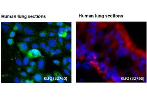 Human lung epithelial cell