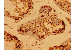 Immunohistochemistry of paraffin-embedded human testis tissue using ABIN7166328 at dilution of 1:100 (WWC2 anticorps  (AA 828-1127))