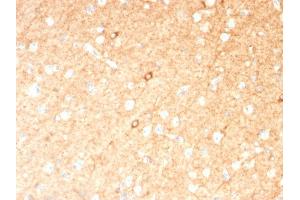 Formalin-fixed, paraffin-embedded human Brain stained with GAD1 (GAD67) Mouse Monoclonal Antibody (GAD1/2391).