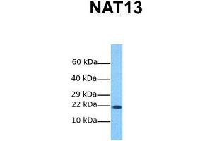 Host:  Rabbit  Target Name:  NAT13  Sample Tissue:  Human MCF7  Antibody Dilution:  1. (NAA50 anticorps  (C-Term))