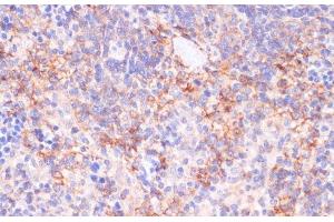 Immunohistochemistry of paraffin-embedded Rat spleen using NT5E / CD73 Polyclonal Antibody at dilution of 1:200 (40x lens). (CD73 anticorps)