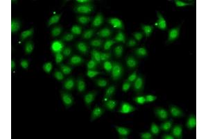 Immunofluorescence analysis of A-549 cells using COPS2 antibody (ABIN6130123, ABIN6138877, ABIN6138878 and ABIN6222819).