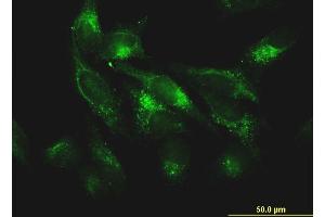 Immunofluorescence of monoclonal antibody to FTL on HeLa cell. (FTL anticorps)