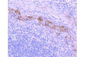 Paraformaldehyde-fixed, paraffin embedded human tonsil, Antigen retrieval by boiling in sodium citrate buffer (pH6) for 15min, Block endogenous peroxidase by 3% hydrogen peroxide for 30 minutes, Blocking buffer at 37°C for 20min, Antibody incubation with Cytokeratin 10 (1D8) Monoclonal Antibody  at 1:50 overnight at 4°C, followed by a conjugated secondary and DAB staining.
