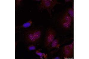 Image no. 2 for anti-Jun B Proto-Oncogene (JUNB) (pSer79) antibody (ABIN196657) (JunB anticorps  (pSer79))