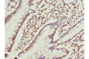Immunohistochemistry of paraffin-embedded human small intestine tissue using ABIN7167209 at dilution of 1:100