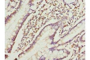 Immunohistochemistry of paraffin-embedded human small intestine tissue using ABIN7167209 at dilution of 1:100 (GTR2 anticorps  (AA 1-250))