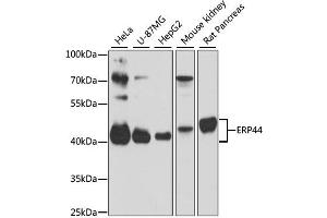 Western blot analysis of extracts of various cell lines, using ERP44 antibody (ABIN6291618) at 1:3000 dilution. (ERP44 anticorps)