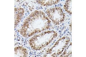 Immunohistochemistry of paraffin-embedded human colon using KIF22 antibody  at dilution of 1:100 (40x lens). (KIF22 anticorps  (AA 456-665))
