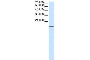 WB Suggested Anti-HDAC6 Antibody Titration:  0. (HDAC6 anticorps  (N-Term))