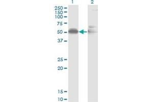 Western Blot analysis of AHSG expression in transfected 293T cell line by AHSG monoclonal antibody (M02), clone 1D8.