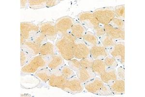 Immunohistochemistry of paraffin embedded mouse skeletal muscle using Junctophilin2 (ABIN7074393) at dilution of 1: 600 (400x lens)