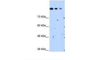 Image no. 2 for anti-SET Domain Containing 2 (SETD2) (AA 323-372) antibody (ABIN321311) (SETD2 anticorps  (AA 323-372))