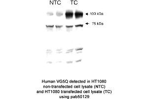 Image no. 1 for anti-Angiogenic Factor with G Patch and FHA Domains 1 (AGGF1) (AA 500-600) antibody (ABIN363438)